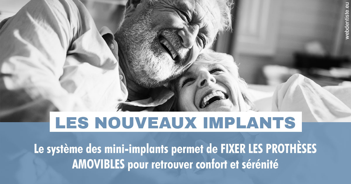https://dr-devoldere-gauthier.chirurgiens-dentistes.fr/Les nouveaux implants 2