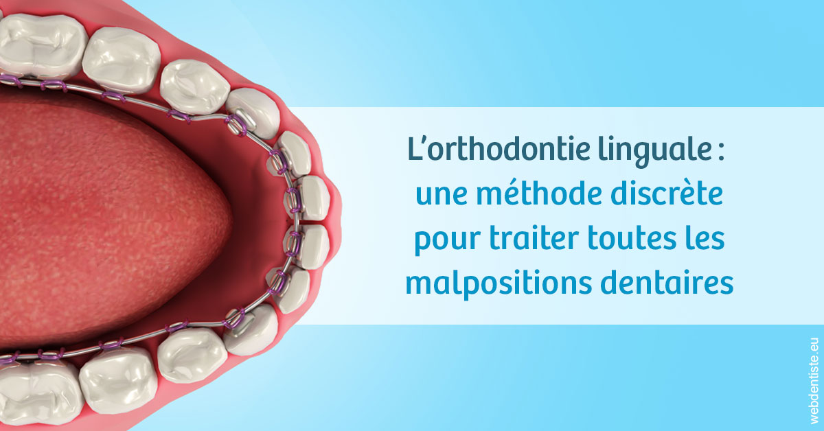 https://dr-devoldere-gauthier.chirurgiens-dentistes.fr/L'orthodontie linguale 1