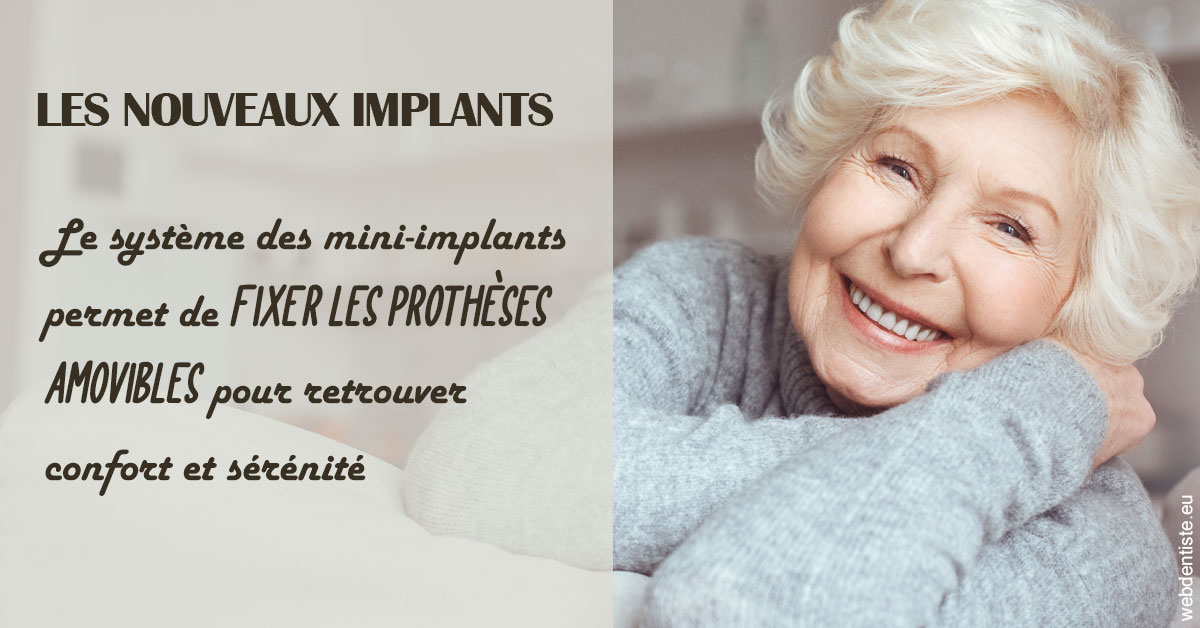 https://dr-devoldere-gauthier.chirurgiens-dentistes.fr/Les nouveaux implants 1