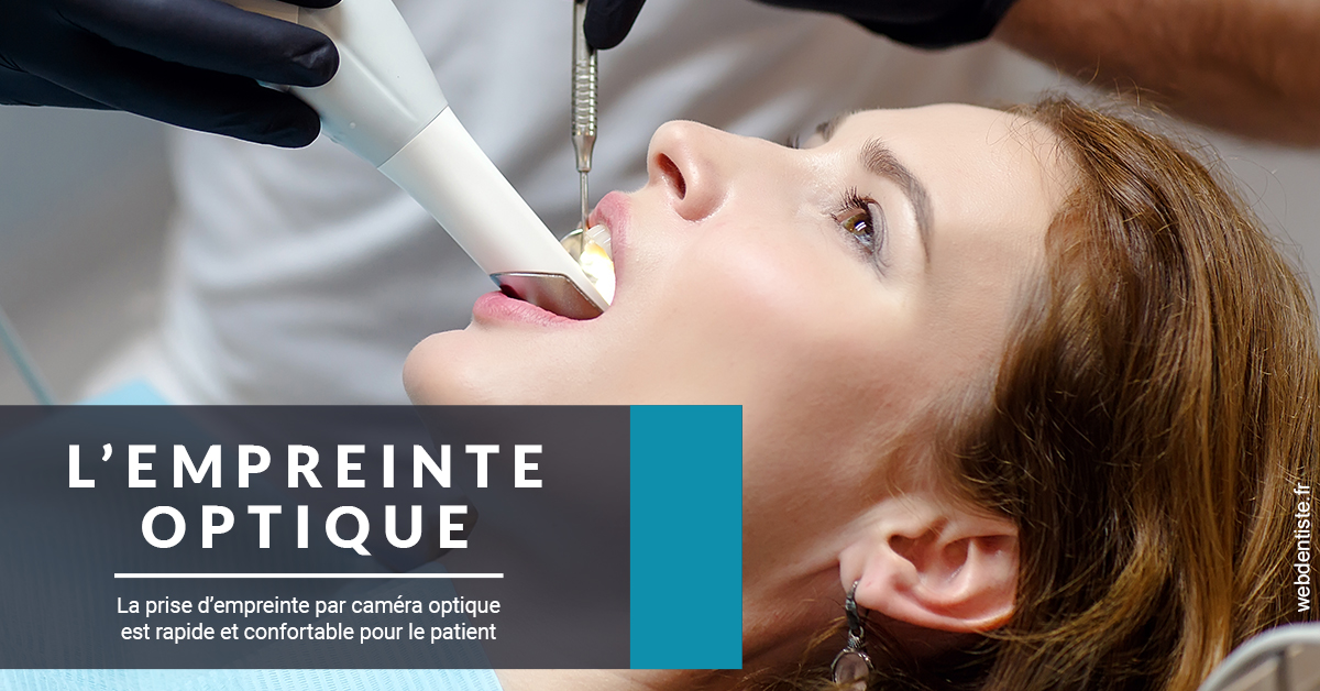 https://dr-devoldere-gauthier.chirurgiens-dentistes.fr/L'empreinte Optique 1