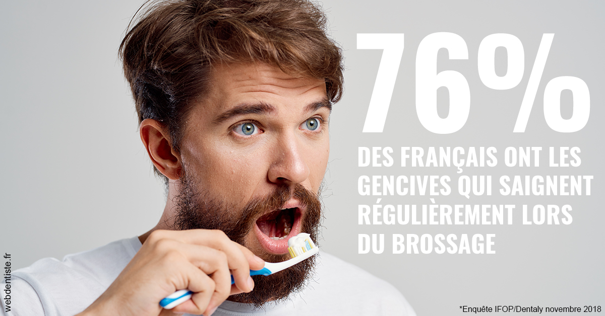 https://dr-devoldere-gauthier.chirurgiens-dentistes.fr/76% des Français 2