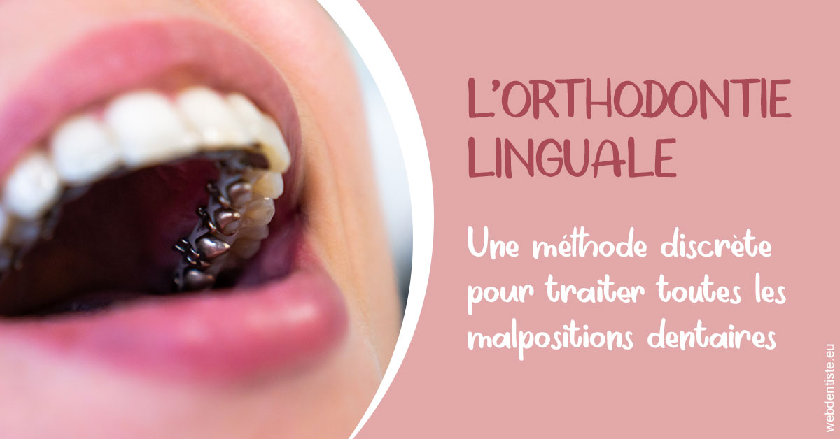 https://dr-devoldere-gauthier.chirurgiens-dentistes.fr/L'orthodontie linguale 2