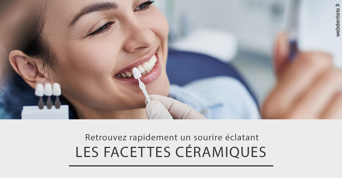 https://dr-devoldere-gauthier.chirurgiens-dentistes.fr/Les facettes céramiques 2