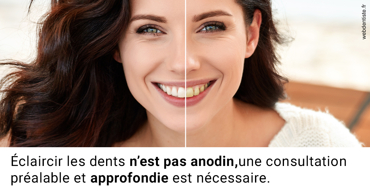 https://dr-devoldere-gauthier.chirurgiens-dentistes.fr/Le blanchiment 2