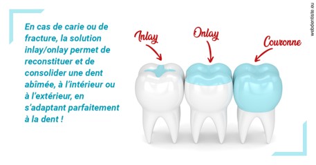 https://dr-devoldere-gauthier.chirurgiens-dentistes.fr/L'INLAY ou l'ONLAY