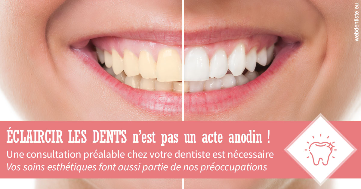 https://dr-devoldere-gauthier.chirurgiens-dentistes.fr/Eclaircir les dents 1