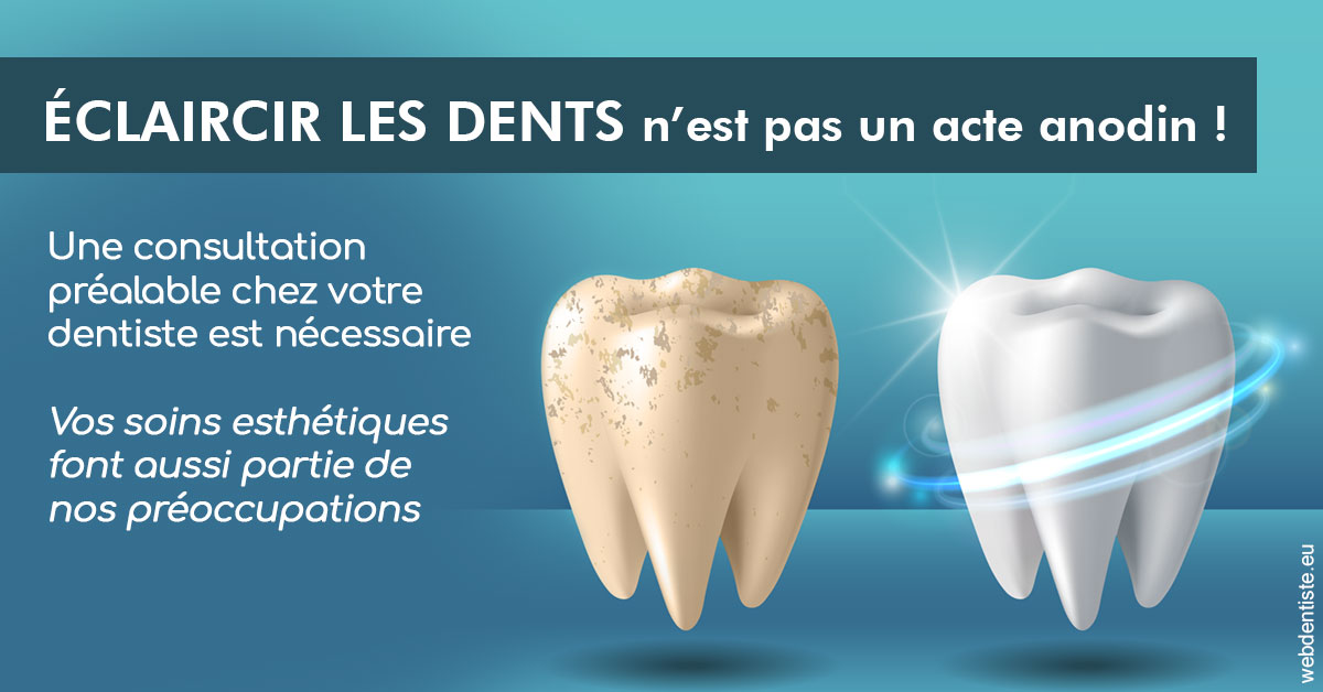 https://dr-devoldere-gauthier.chirurgiens-dentistes.fr/Eclaircir les dents 2