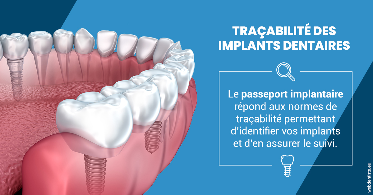 https://dr-devoldere-gauthier.chirurgiens-dentistes.fr/T2 2023 - Traçabilité des implants 1