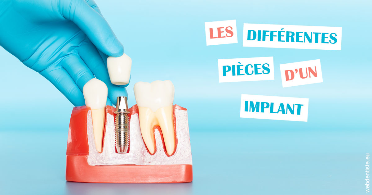 https://dr-devoldere-gauthier.chirurgiens-dentistes.fr/Les différentes pièces d’un implant 2