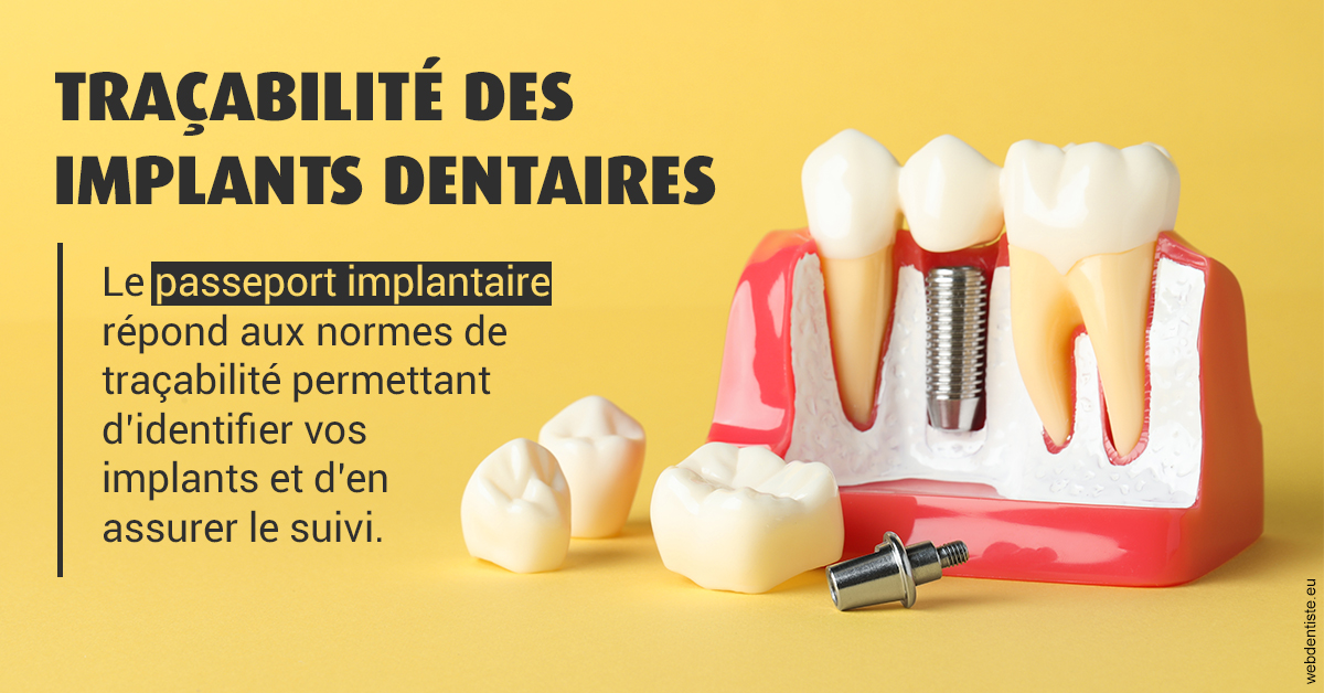 https://dr-devoldere-gauthier.chirurgiens-dentistes.fr/T2 2023 - Traçabilité des implants 2