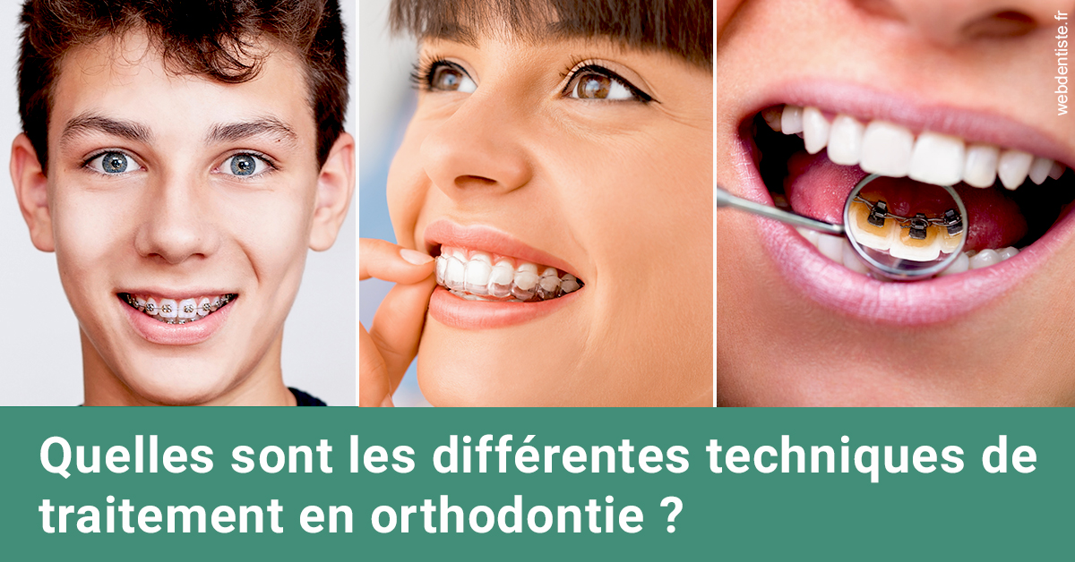 https://dr-devoldere-gauthier.chirurgiens-dentistes.fr/Les différentes techniques de traitement 2