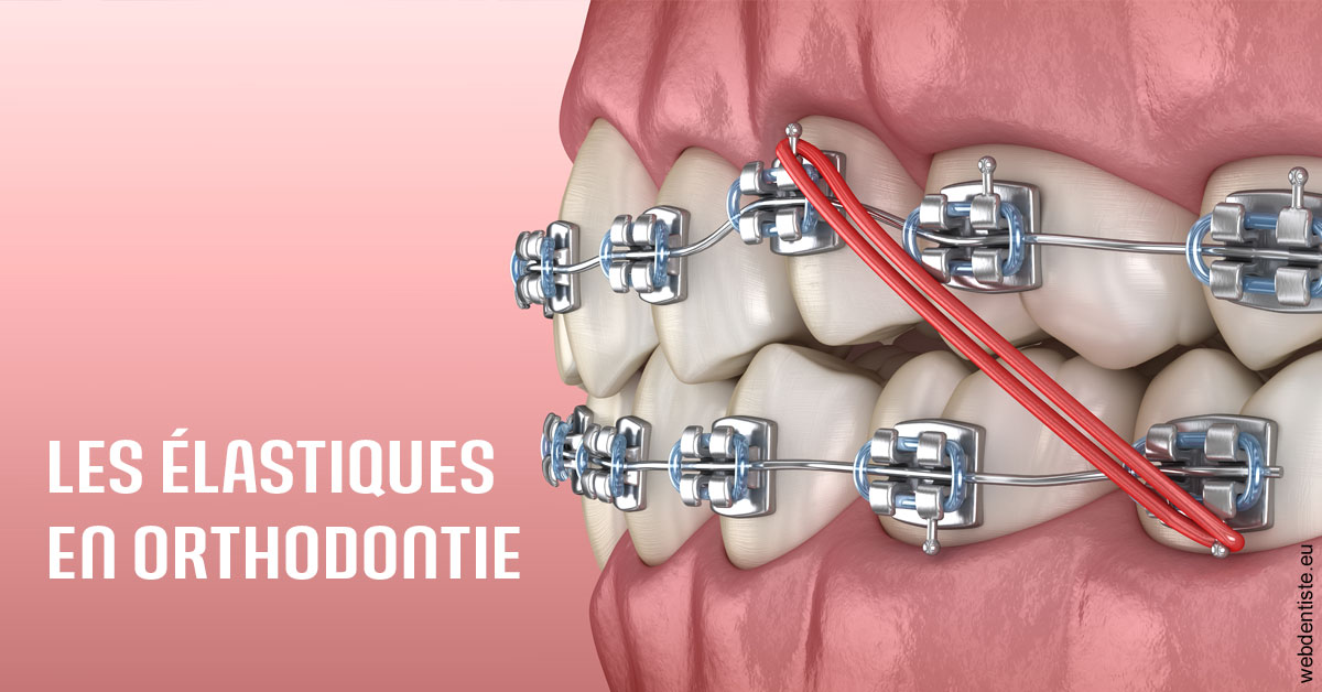 https://dr-devoldere-gauthier.chirurgiens-dentistes.fr/Elastiques orthodontie 2