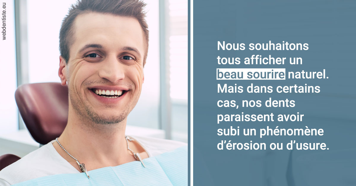 https://dr-devoldere-gauthier.chirurgiens-dentistes.fr/Érosion et usure dentaire