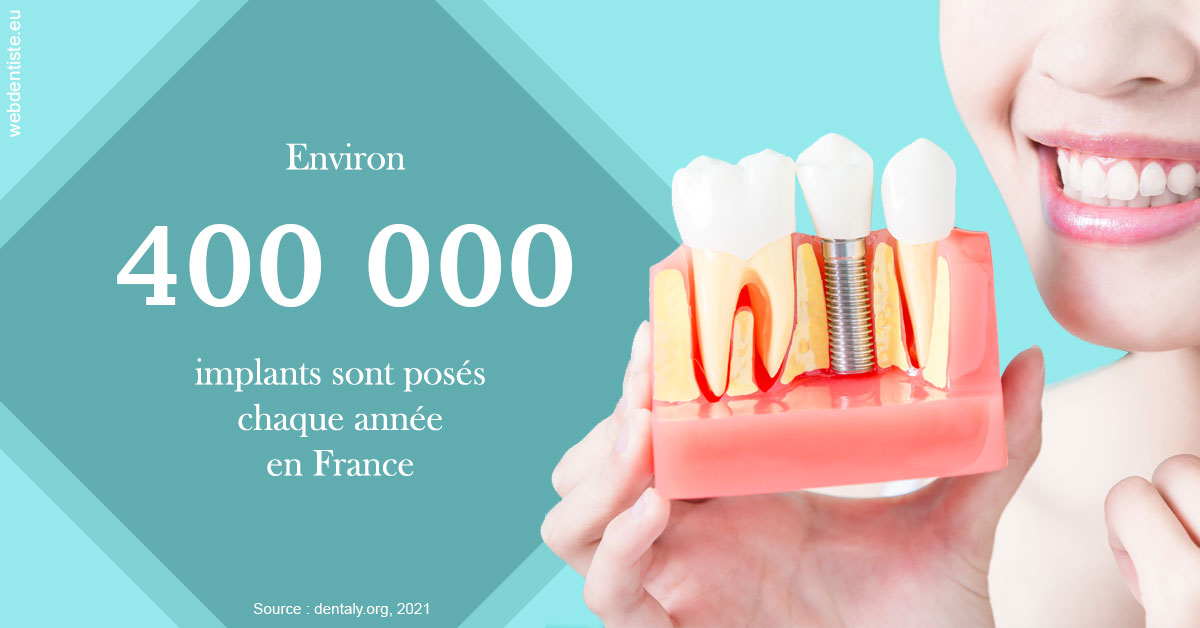 https://dr-devoldere-gauthier.chirurgiens-dentistes.fr/Pose d'implants en France 2