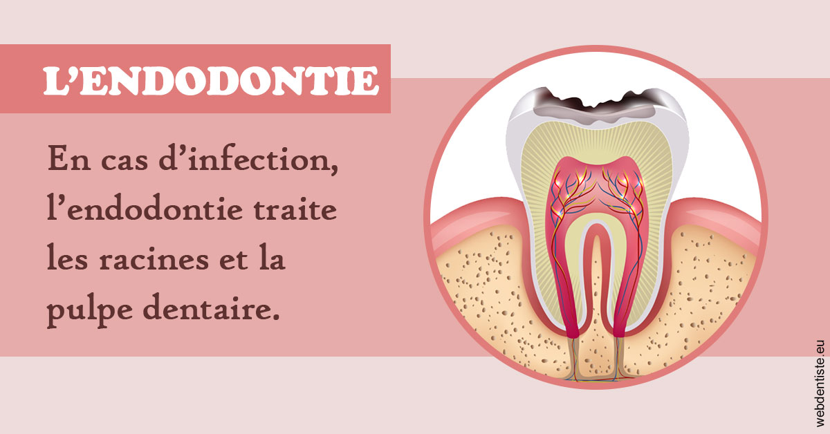 https://dr-devoldere-gauthier.chirurgiens-dentistes.fr/L'endodontie 2